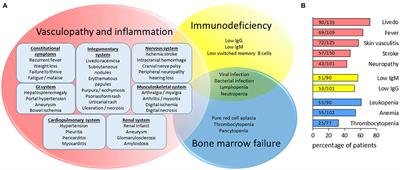 Vasculopathy, Immunodeficiency, and Bone Marrow Failure: The Intriguing Syndrome Caused by Deficiency of Adenosine Deaminase 2